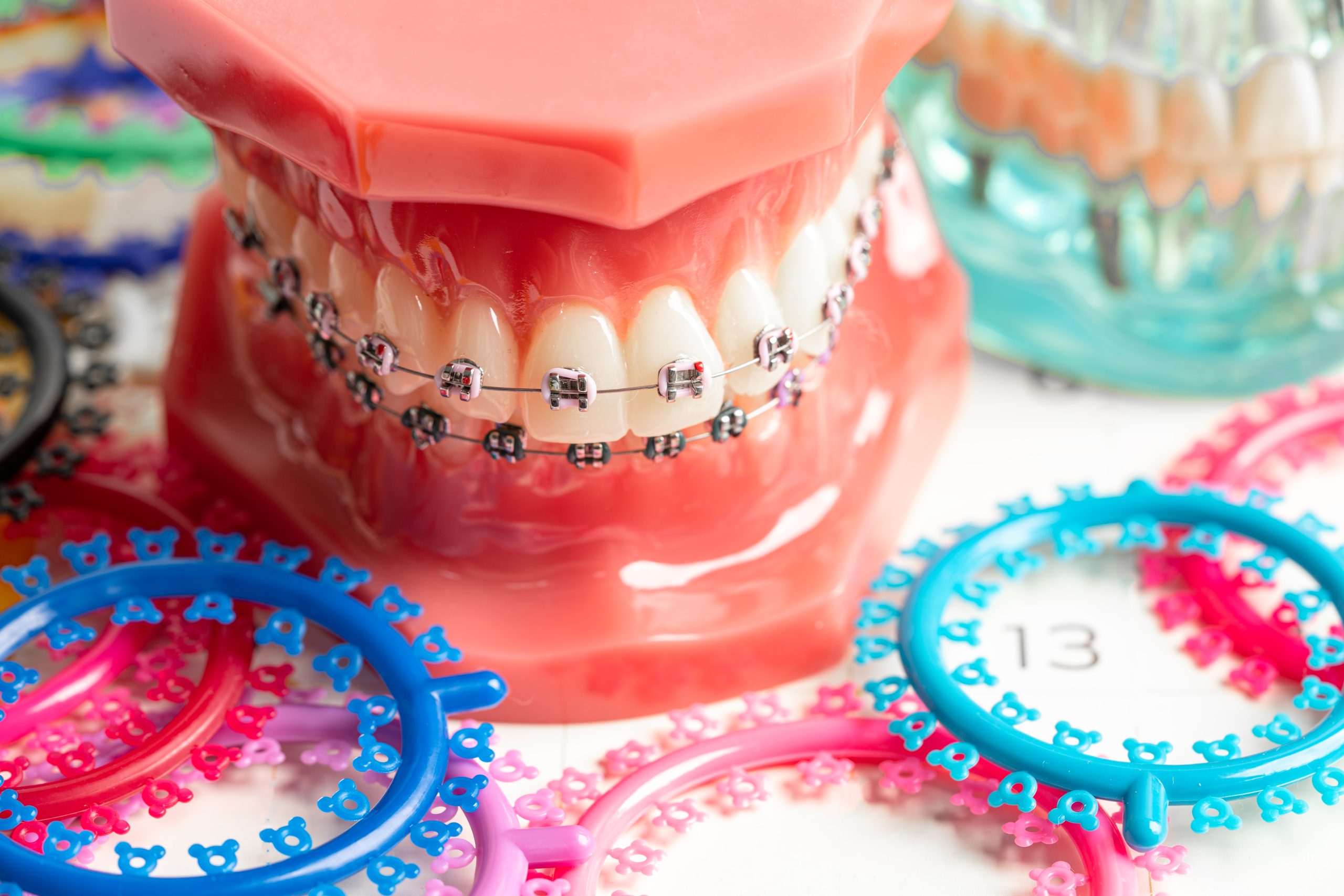 Orthodontic ligatures rings and ties, elastic rubber bands on orthodontic braces, model for dentist studying about dentistry.